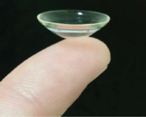 keratoconus contact lenses