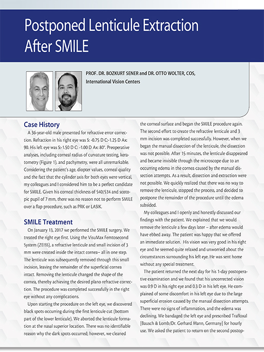 Postponed Lenticule Extraction After SMILE