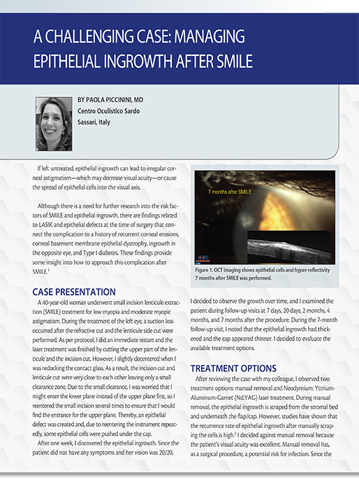 A Challenging Case: Managing Epithelial Ingrowth After SMILE