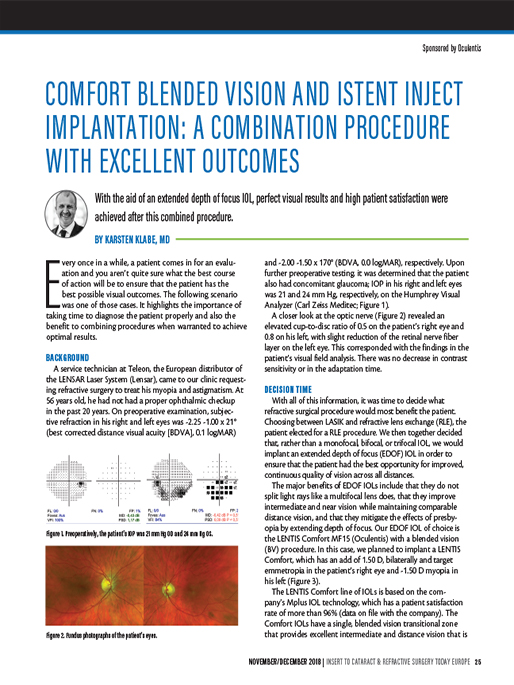 Comfort Blended Vision and iStent Inject Implantation: A Combination Procedure With Excellent Outcomes