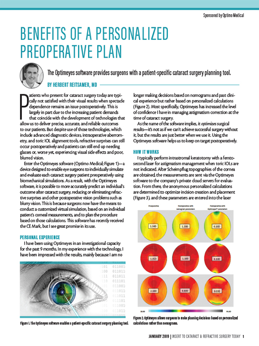 Benefits of a Personalized Preoperative Plan