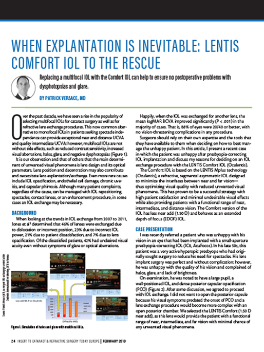 When Explantation is Inevitable: LENTIS Comfort IOL to the Rescue
