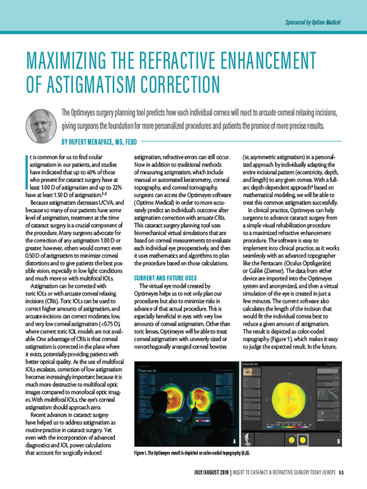 Maximizing the Refractive Enhancement of Astigmatism Correction