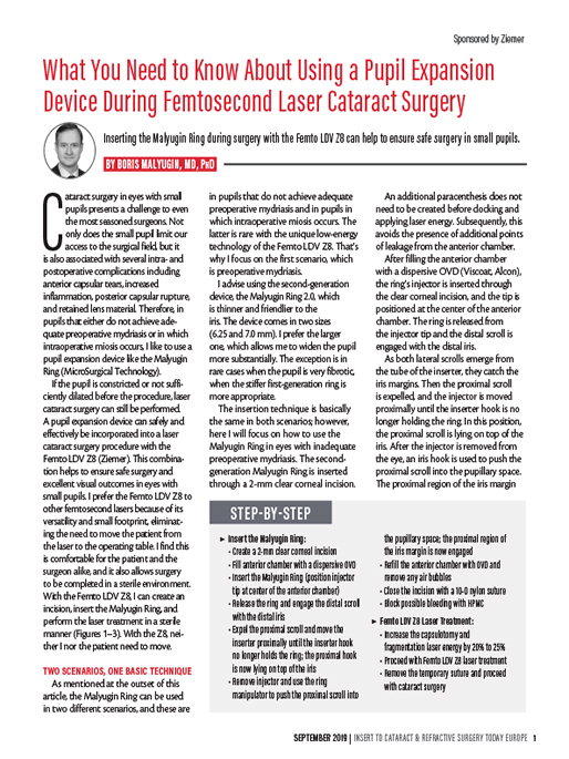 What You Need to Know About Using a Pupil Expansion Device During Femtosecond Laser Cataract Surgery