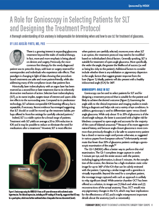 A Role for Gonioscopy in Selecting Patients for SLT and Designing the Treatment Protocol